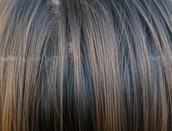 Dampak Stres pada Kerontokan Rambut